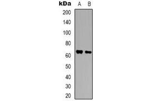 Image no. 3 for anti-Brain-Enriched Guanylate Kinase-Associated (BEGAIN) (C-Term) antibody (ABIN2801399)