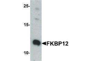 Image no. 2 for anti-FK506 Binding Protein 1A, 12kDa (FKBP1A) (Internal Region) antibody (ABIN6656194)