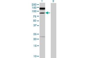 Image no. 1 for anti-Tetratricopeptide Repeat Domain 30A (TTC30A) (AA 1-665) antibody (ABIN530087)