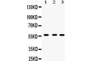 Image no. 1 for anti-Cytochrome P450, Family 27, Subfamily B, Polypeptide 1 (CYP27B1) (AA 475-508), (C-Term) antibody (ABIN3042787)