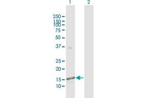 Western Blot analysis of GALNT3 expression in transfected 293T cell line by GALNT3 MaxPab polyclonal antibody.