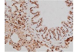 Image no. 14 for anti-Mast/stem Cell Growth Factor Receptor (KIT) (pTyr721) antibody (ABIN6256004)