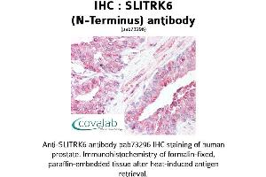 Image no. 2 for anti-SLIT and NTRK-Like Family, Member 6 (SLITRK6) (N-Term) antibody (ABIN1739443)
