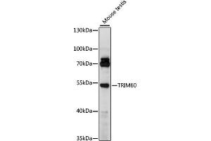 TRIM60 Antikörper  (AA 1-300)