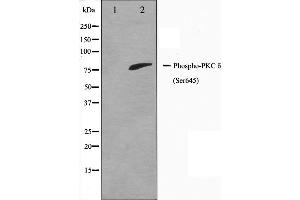 Image no. 2 for anti-Protein Kinase C, delta (PKCd) (pSer645) antibody (ABIN6256394)