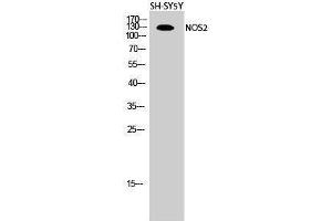 NOS2 Antikörper  (Thr177)