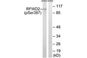 Image no. 1 for anti-Ring Finger and WD Repeat Domain 2, E3 Ubiquitin Protein Ligase (RFWD2) (AA 353-402), (pSer387) antibody (ABIN1532168)