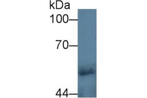 Image no. 3 for Carboxypeptidase E (CPE) ELISA Kit (ABIN6730971)