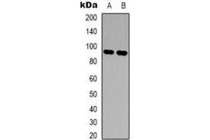 Image no. 2 for anti-FER Tyrosine Kinase (FER) antibody (ABIN2801404)