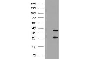 Image no. 8 for anti-Proteasome (Prosome, Macropain) Subunit, beta Type, 7 (PSMB7) (AA 58-277) antibody (ABIN1491598)