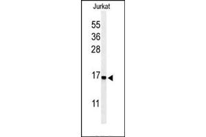 Image no. 1 for anti-Ribosomal Protein S25 (RPS25) (AA 7-36), (N-Term) antibody (ABIN954617)