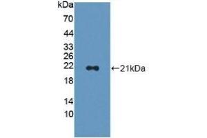 CAP2 anticorps  (AA 317-455)