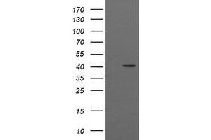 Image no. 10 for anti-Acetyl-CoA Acyltransferase 2 (ACAA2) antibody (ABIN2715630)