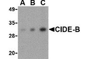 Image no. 2 for anti-Cell Death-Inducing DFFA-Like Effector B (CIDEB) (Middle Region) antibody (ABIN1030906)