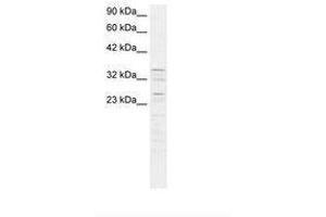 Image no. 2 for anti-Zinc Finger Protein 385A (ZNF385A) (AA 256-305) antibody (ABIN6735827)
