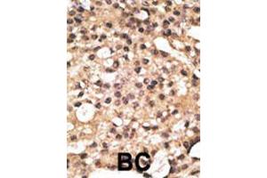 Image no. 2 for anti-Autophagy related 4B Cysteine Peptidase (ATG4B) (AA 16-45), (N-Term) antibody (ABIN388494)