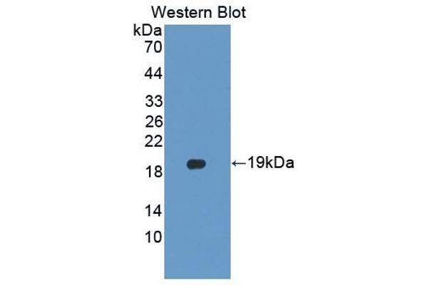PLTP antibody  (AA 337-479)