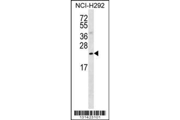 anti-Slowmo Homolog 2 (SLMO2) (Center) antibody