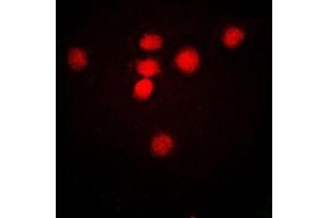 Image no. 1 for anti-MRE11 Meiotic Recombination 11 Homolog A (S. Cerevisiae) (MRE11A) (Center) antibody (ABIN2706589)