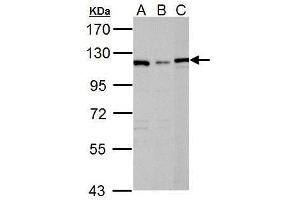 Image no. 1 for anti-Dihydropyrimidine Dehydrogenase (DPYD) (N-Term) antibody (ABIN2856926)