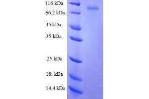 Image no. 1 for Keratin 6A (KRT6A) (AA 2-564) protein (GST tag) (ABIN5709833)