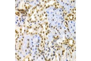 Image no. 1 for anti-Mitogen-Activated Protein Kinase 3 (MAPK3) (N-Term) antibody (ABIN3020725)
