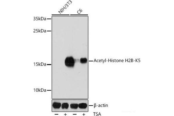 Histone H2B anticorps  (acLys5)