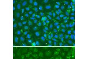 Immunofluorescence analysis of A549 cells using SRGN Polyclonal Antibody