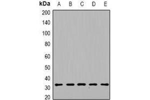 Image no. 1 for anti-Deoxyguanosine Kinase (DGUOK) (full length) antibody (ABIN6004402)