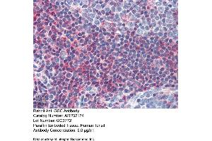 Image no. 2 for anti-Goosecoid Homeobox (GSC) (N-Term) antibody (ABIN2779490)