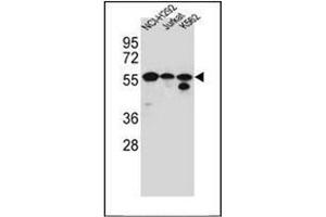 Image no. 1 for anti-Forkhead Box N2 (FOXN2) (AA 1-30), (N-Term) antibody (ABIN952377)
