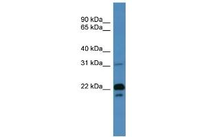 Image no. 1 for anti-Brain Abundant, Membrane Attached Signal Protein 1 (BASP1) (N-Term) antibody (ABIN2788266)