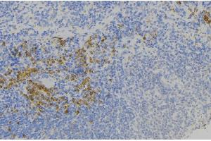 ABIN6277802 at 1/100 staining Human lymph node tissue by IHC-P.