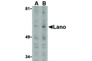LASS5 antibody  (N-Term)