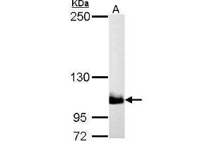 Image no. 1 for anti-Phosphoinositide-3-Kinase, Catalytic, beta Polypeptide (PIK3CB) (Internal Region) antibody (ABIN2856792)