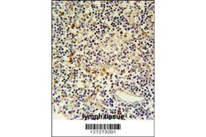 Immunohistochemistry (IHC) image for anti-Coronin 6 (CORO6) antibody (ABIN2158333)