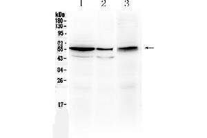 Image no. 2 for anti-Aldehyde Dehydrogenase 1 Family, Member A3 (ALDH1A3) (AA 37-154) antibody (ABIN5518802)