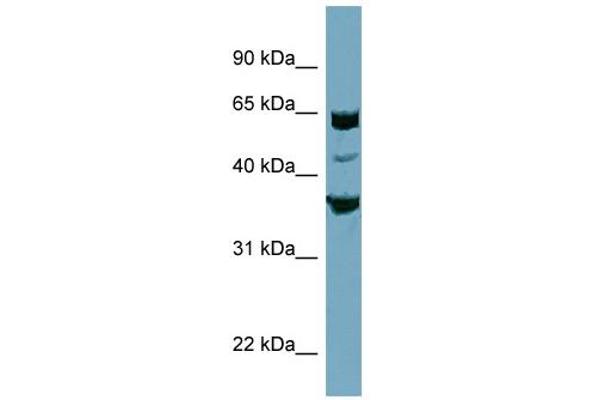 SEC22C anticorps  (Middle Region)