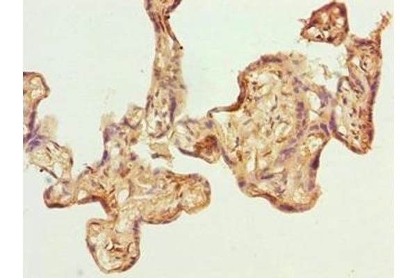GPSM3 anticorps  (AA 1-160)