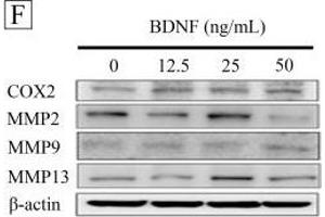 Image no. 4 for anti-Matrix Metallopeptidase 13 (Collagenase 3) (MMP13) (Internal Region) antibody (ABIN2854829)