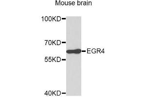 Image no. 1 for anti-Early Growth Response 4 (EGR4) antibody (ABIN1872466)