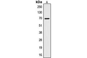 Image no. 2 for anti-CTP Synthase (CTPS) (N-Term) antibody (ABIN2707457)