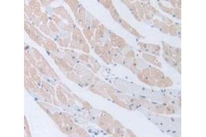 Image no. 3 for anti-Bone Morphogenetic Protein 5 (BMP5) (AA 315-452) antibody (ABIN1175491)