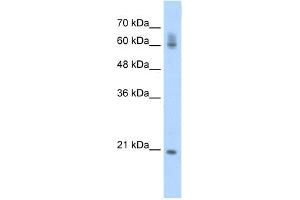 anti-FIP1 Like 1 (FIP1L1) (C-Term) antibody