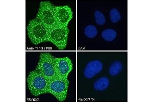 TSPO anticorps  (C-Term)