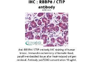 Image no. 2 for anti-Retinoblastoma Binding Protein 8 (RBBP8) (AA 452-747) antibody (ABIN1738767)