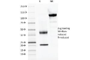 Image no. 1 for anti-Paired Box Gene 2a (PAX2A) (AA 223-354) antibody (ABIN6940252)
