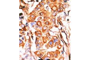 Image no. 2 for anti-Glycerol Kinase (GK) (AA 487-515), (C-Term) antibody (ABIN5531298)