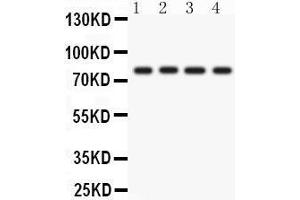 Image no. 1 for anti-Protein Kinase C, eta (PRKCH) (AA 30-389) antibody (ABIN3043361)