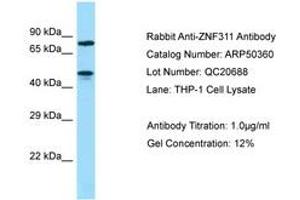 Image no. 1 for anti-Zinc Finger Protein 311 (ZNF311) (AA 187-236) antibody (ABIN6749919)